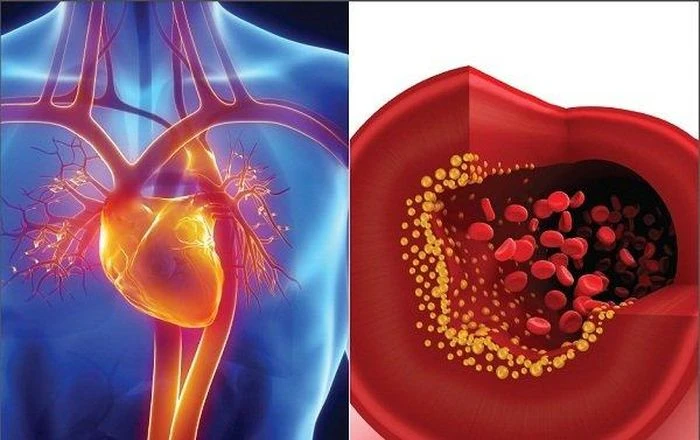 Rối loạn mỡ máu ở người cao tuổi nên ăn gì? - Hình 1