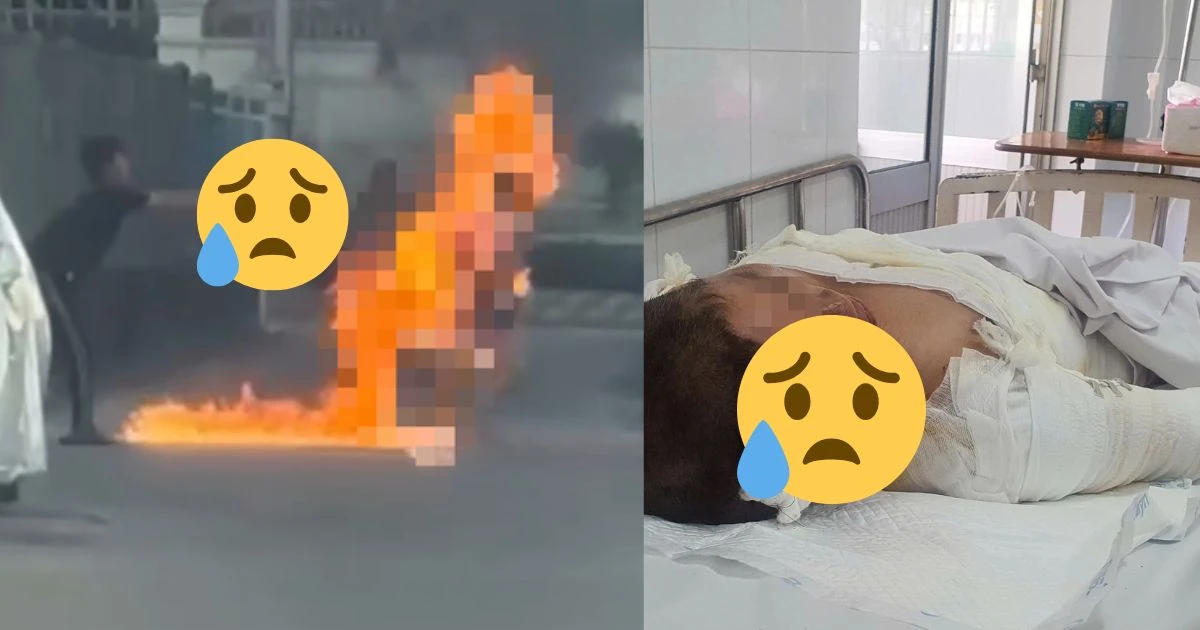 Vụ mẹ bị con tạt xăng: bỏng 46%, cố lắc đầu nói 1 câu khiến CĐM chua xót - Hình 7