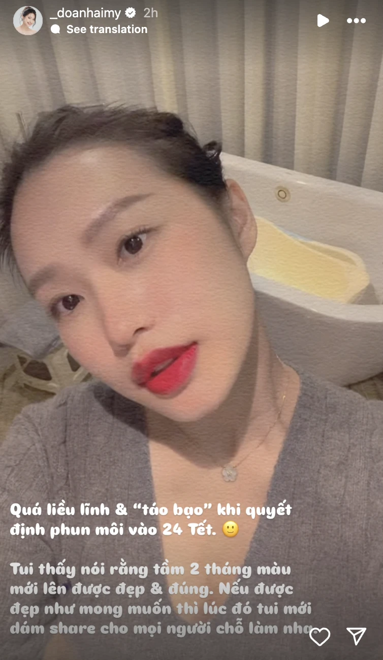 Vợ Văn Hậu lộ diện mạo lạ hậu dao kéo, fan nhảy số so với Kim Ji Won? - Hình 2