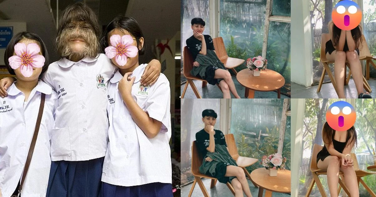 Người nhiều lông nhất thế giới: khác lạ sau 7 năm cạo sạch, công khai bạn trai - Hình 12