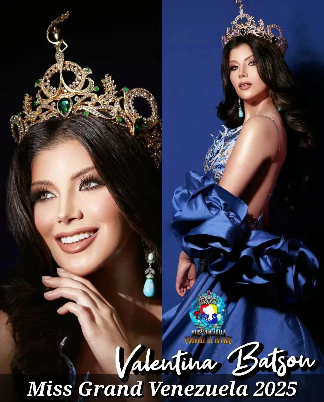 Miss Global 2025: Đại diện Venezuela khẩu chiến trên MXH trước chung kết - Hình 5