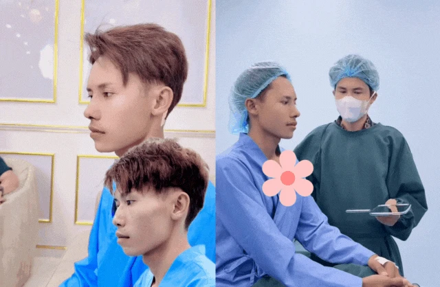 Sít rịt Nam vương flex diện mạo 1 tuần dao kéo, bị dụ giống Quang Linh, CĐM lo? - Hình 1