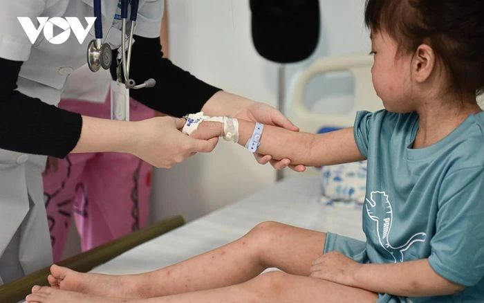 Cận cảnh khu điều trị cho bệnh nhân mắc sởi ở Bệnh viện Nhi Hà Nội - Hình 5