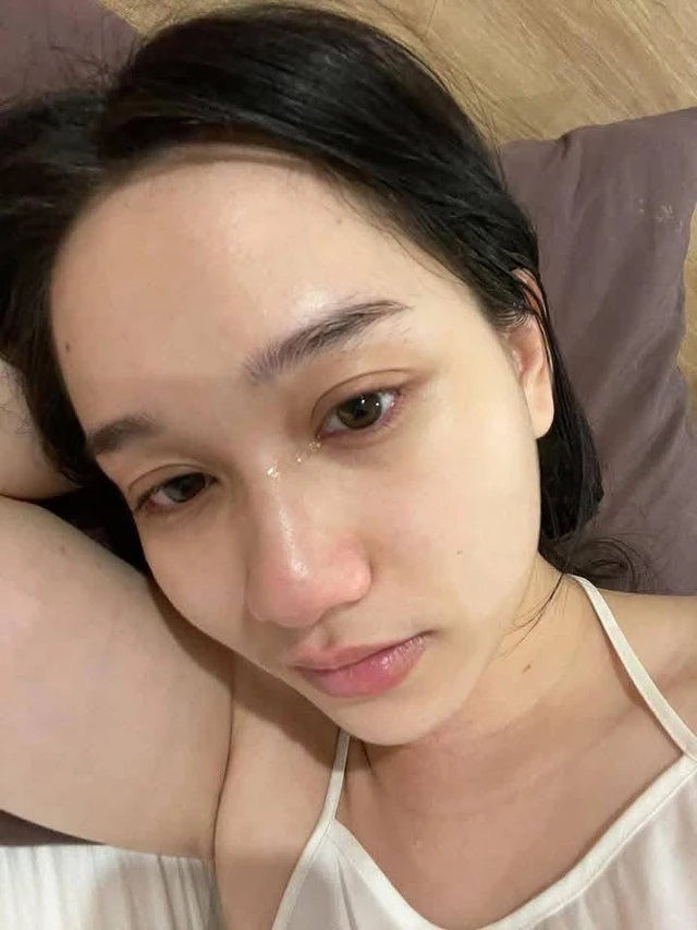 Hình ảnh mới nhất gây bất ngờ của Trúc Anh (Mắt Biếc) hậu nâng cơ mặt - Hình 5