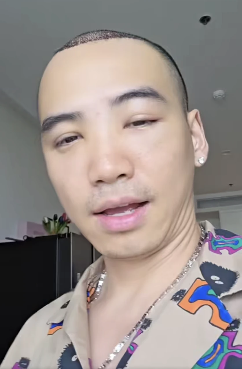 Chồng HHen Niê phù mặt như cá la hán, clip hiện trạng khiến dân tình ngơ ngác - Hình 2