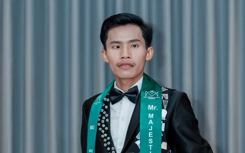 Lai Thai thay đầu, xử luôn nét đặc trưng trên mặt, fan hú hét đợi diện mạo mới - Hình 5