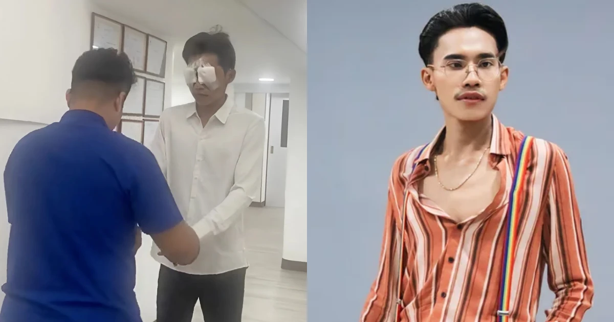 Lai Thai thay đầu, xử luôn nét đặc trưng trên mặt, fan hú hét đợi diện mạo mới - Hình 8
