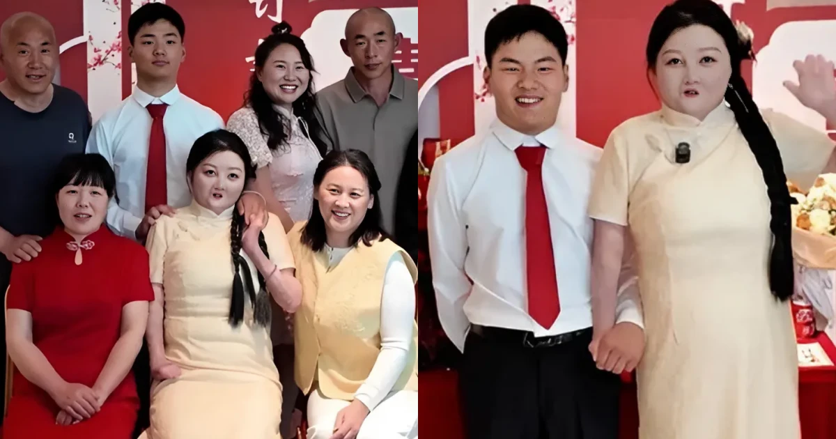 Cô gái bỏng 95%, bỏ 9 ngón tay sống kỳ diệu, vừa đính hôn với người đặc biệt - Hình 6