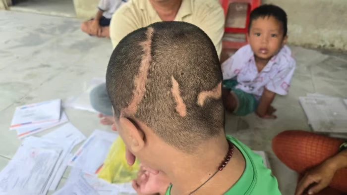 Vụ bé trai 7 lần mổ sọ: liệt nửa người bên phải, cha đèo con đến tòa làm 1 điều - Hình 2