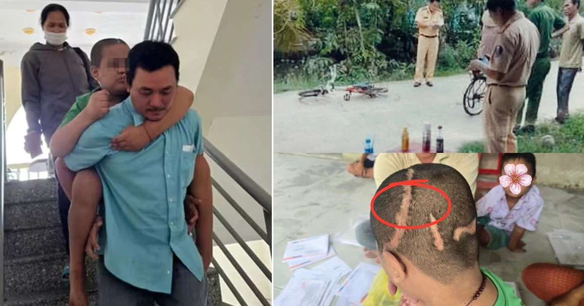Vụ bé trai 7 lần mổ sọ: liệt nửa người bên phải, cha đèo con đến tòa làm 1 điều - Hình 7