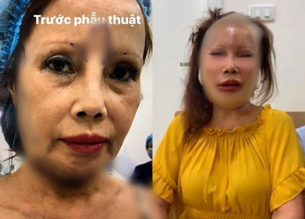 Cô dâu Thu Sao live ăn uống, diện mạo hiện tại sốc nặng, hết tiề.n căng da? - Hình 5