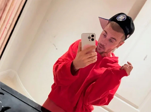 Justin Bieber lộ ảnh như bị bẻ cong, vật lộn với sức khỏe tâm thần đáng lo - Hình 1