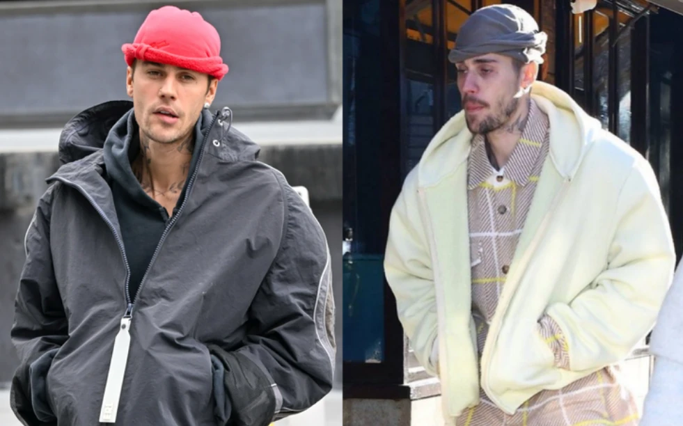 Justin Bieber lộ ảnh như bị bẻ cong, vật lộn với sức khỏe tâm thần đáng lo - Hình 4