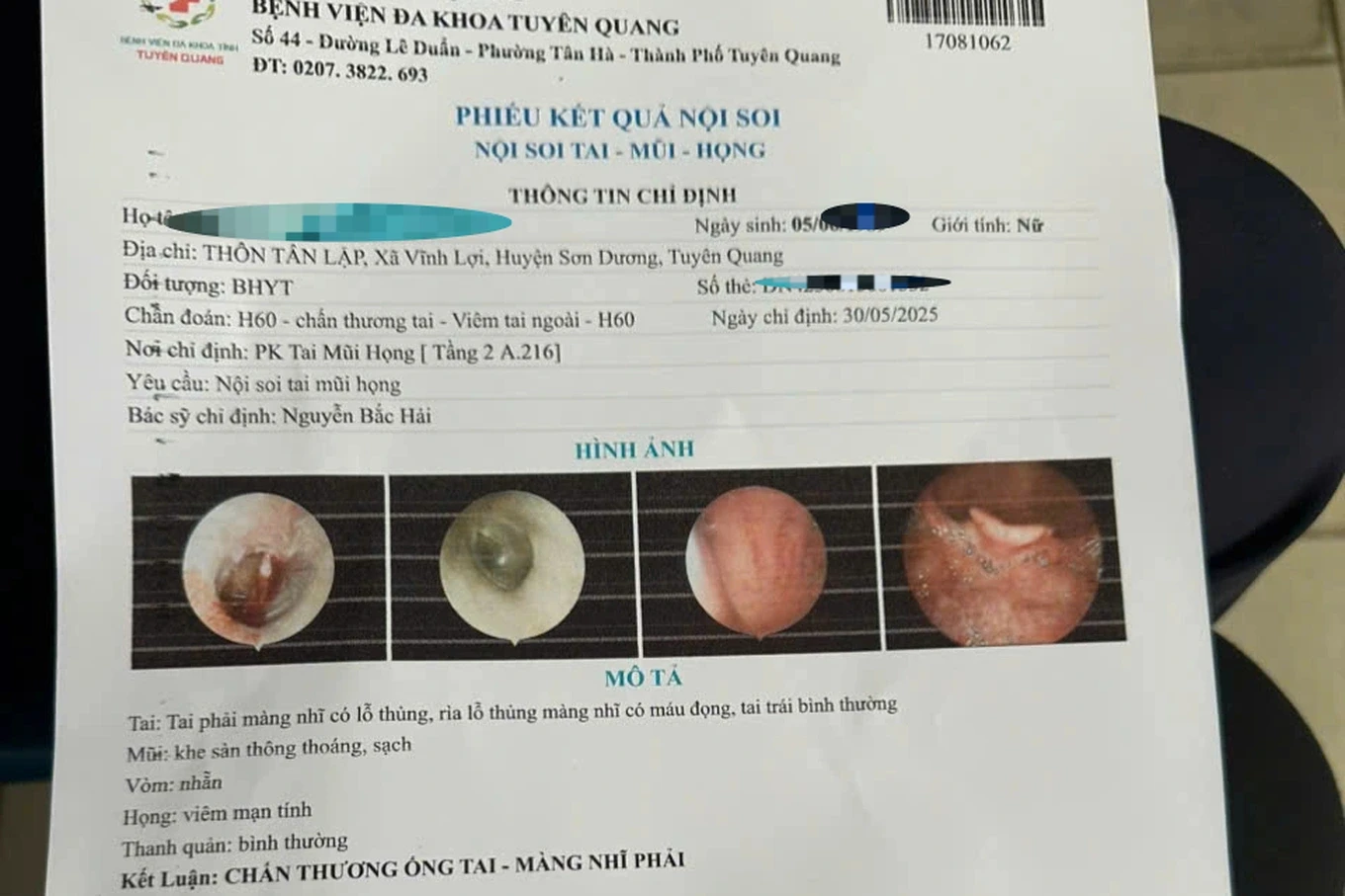 Vụ người vợ bị chồng đánh ở Tuyên Quang, tinh thần bấn loạn CA chưa thể điều tra - Hình 4