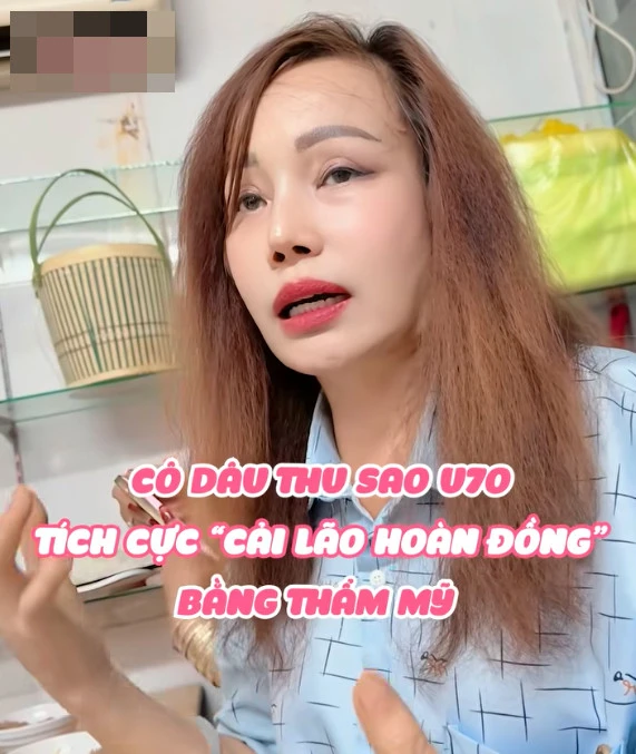Cô dâu Thu Sao lại dao kéo vì sợ chồng bỏ, nhan sắc ngỡ ngàng, bàn tay mới sốc? - Hình 4