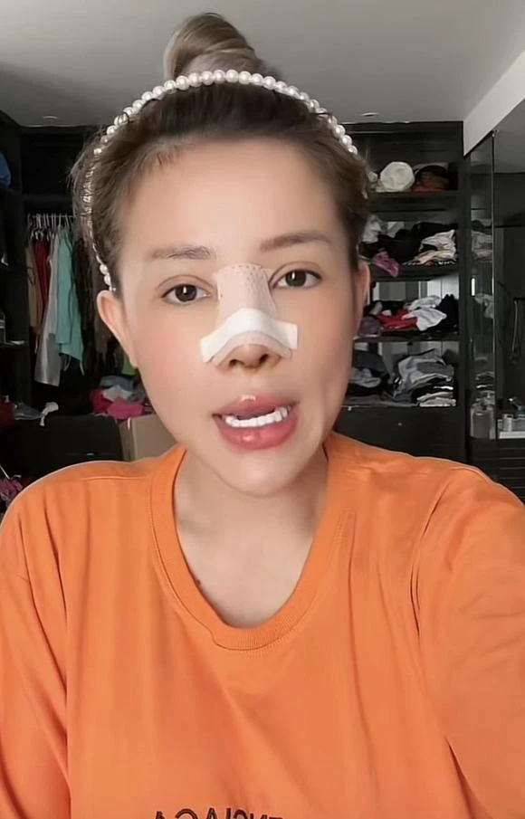 Ngân 98 nhập viện vì mũi viêm sau 11 lần sửa, sau 2 ngày quyết tháo băng đi diễn - Hình 6