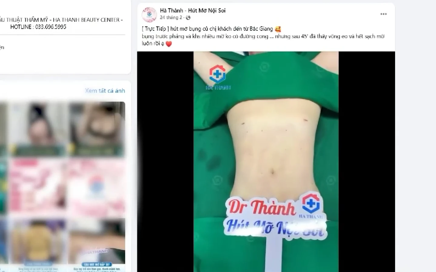 Vén màn hoạt động kinh hoàng bên trong spa hút mỡ ma giữa lòng Hà Nội - Hình 5