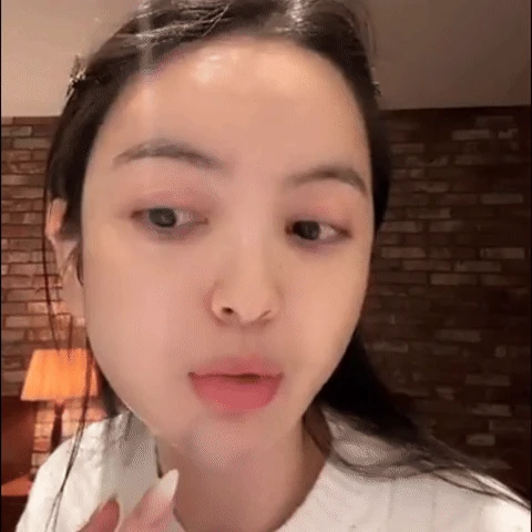 Chu Thanh Huyền lộ cằm bầm tím trên livestream, netizen tiếc thay nhan sắc thời chưa dao kéo - Hình 1