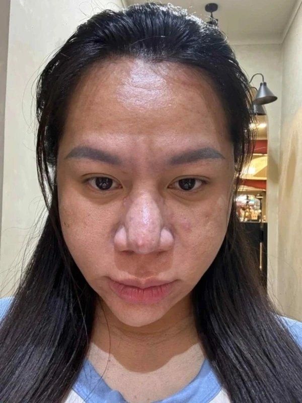 Cô gái cãi lời bác sĩ khi mang thai, đăng ảnh trước và sau khiến CĐM sửng sốt - Hình 3