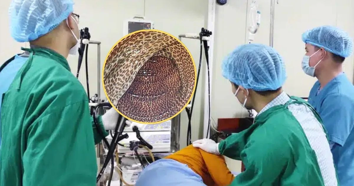 2 năm uống trà giảm cân, người đàn ông xanh mặt khi nội soi ruột? - Hình 8