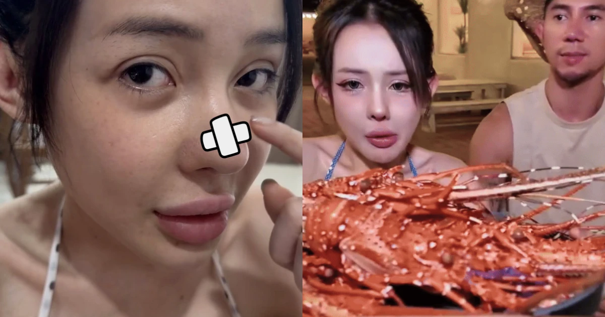 Ngân 98 suýt cắt mũi sau 11 lần dao kéo, còn thản nhiên ăn đồ độc, CĐM la ó? - Hình 7