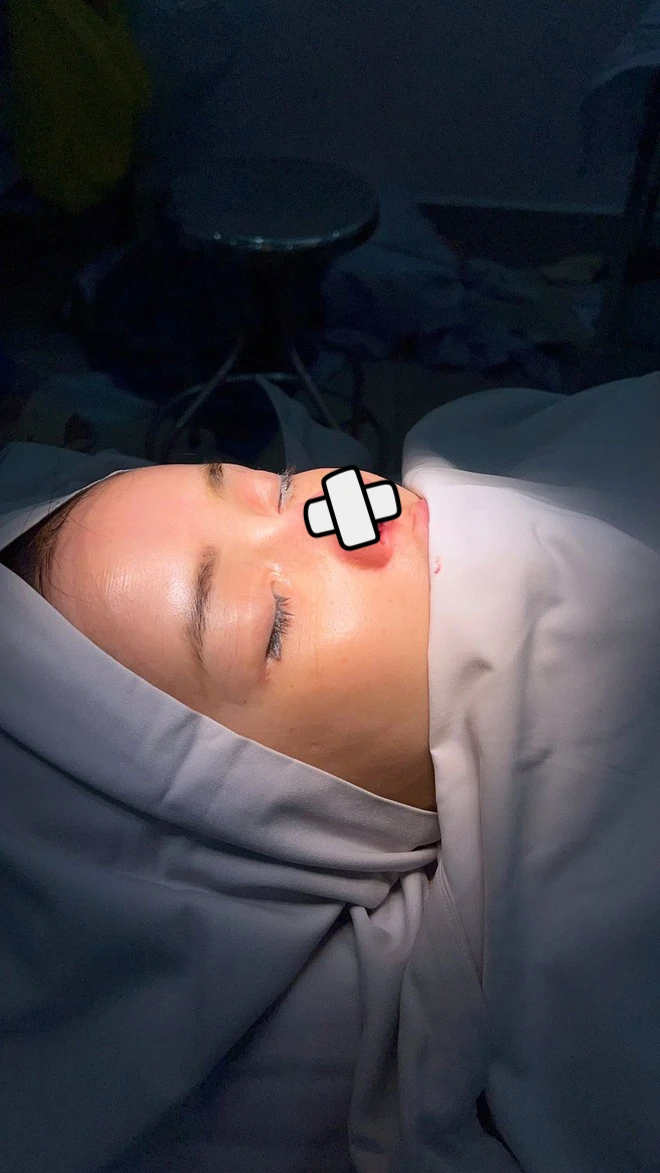 Ngân 98 suýt cắt mũi sau 11 lần dao kéo, còn thản nhiên ăn đồ độc, CĐM la ó? - Hình 2
