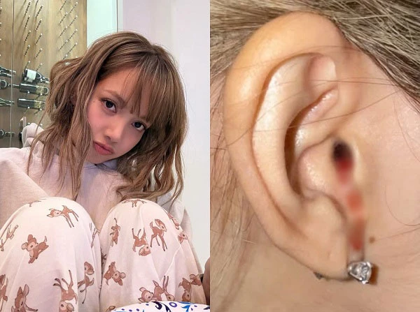Rosé vừa hội ngộ G-Dragon đã tranh cãi, gặp sự cố hát live, lệch tone, vỡ giọng - Hình 5