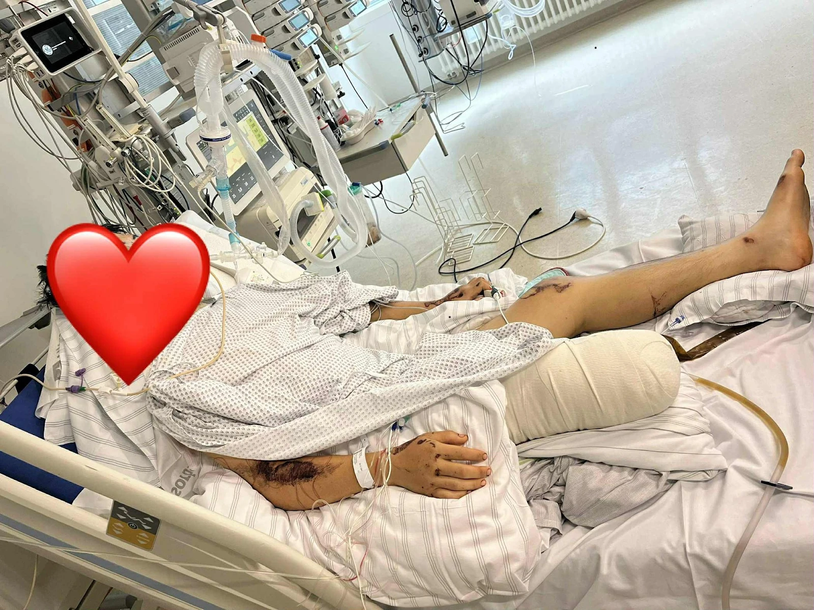 Vụ TikToker Bốp gặp nạn ở Đức: nguy cơ tàn tật suốt đời, mẹ khóc lóc cầu cứu MXH - Hình 7