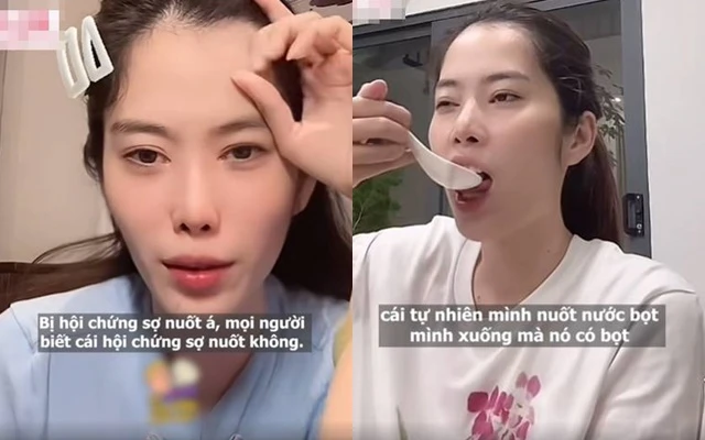 Nam Em bất ngờ tái xuất phốt tình cũ, tiết lộ bệnh lạ, CĐM hoang mang - Hình 2
