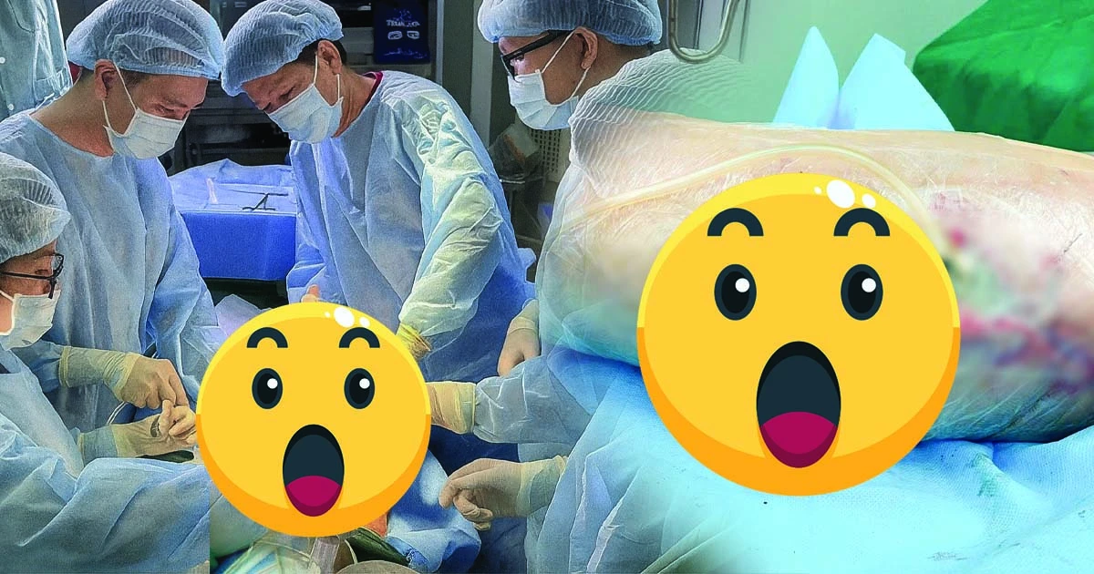 Tiêm filler toàn thân: cô gái kêu gào, lộ bó cơ, bác sĩ vào cuộc mổ nghẹt thở - Hình 6