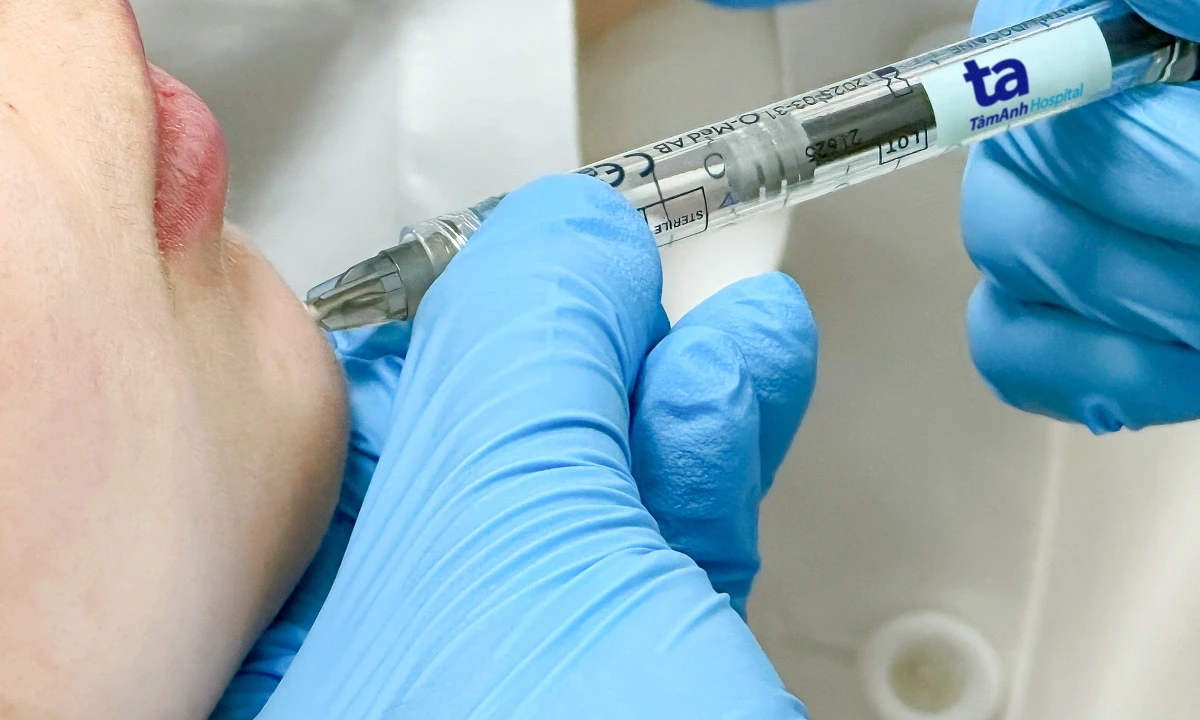 Tiêm filler toàn thân: cô gái kêu gào, lộ bó cơ, bác sĩ vào cuộc mổ nghẹt thở - Hình 5