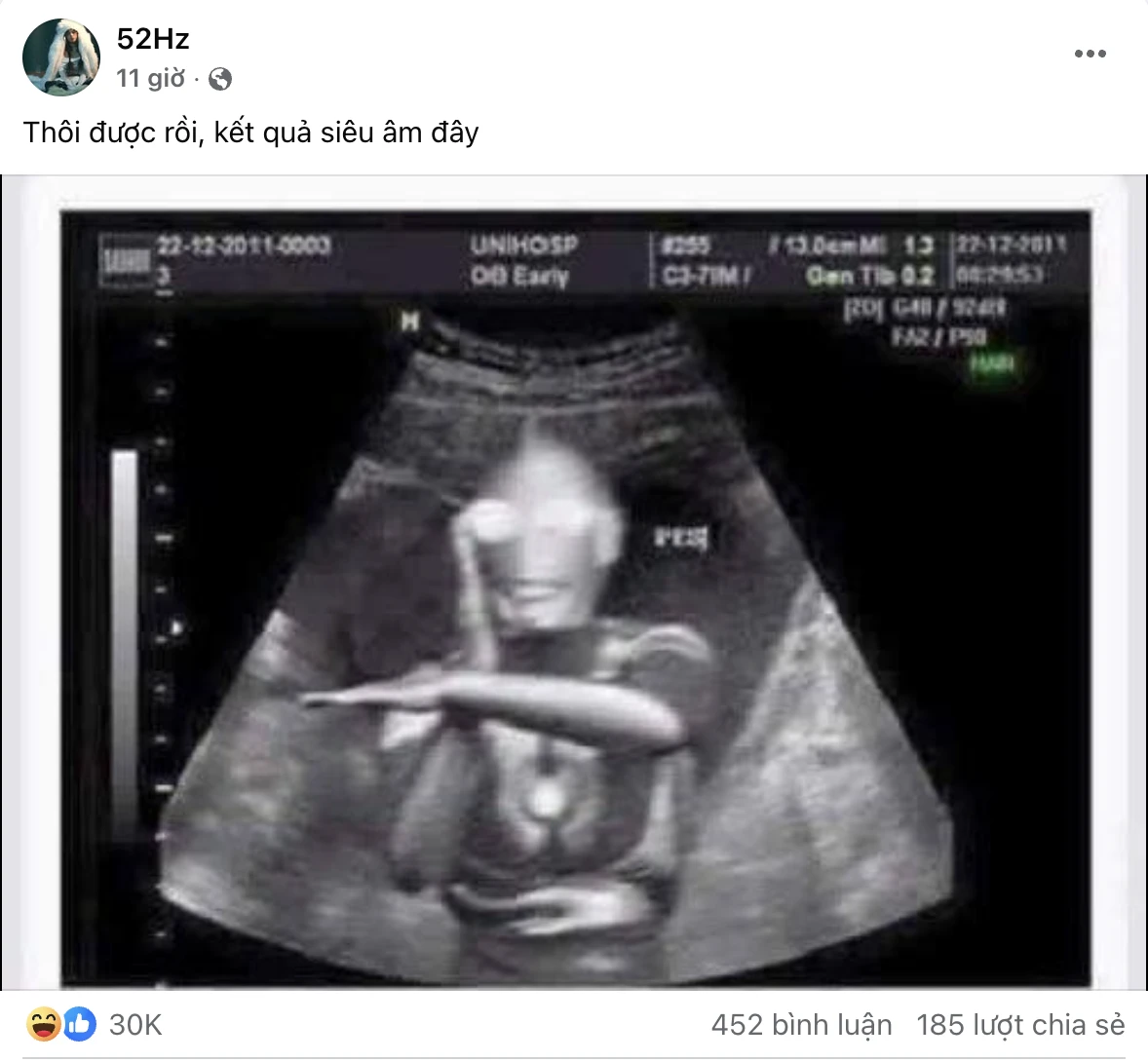 1 Em Xinh nghi mang thai lúc ghi hình, tung luôn siêu âm thai kỳ khiến CĐM sốc! - Hình 3