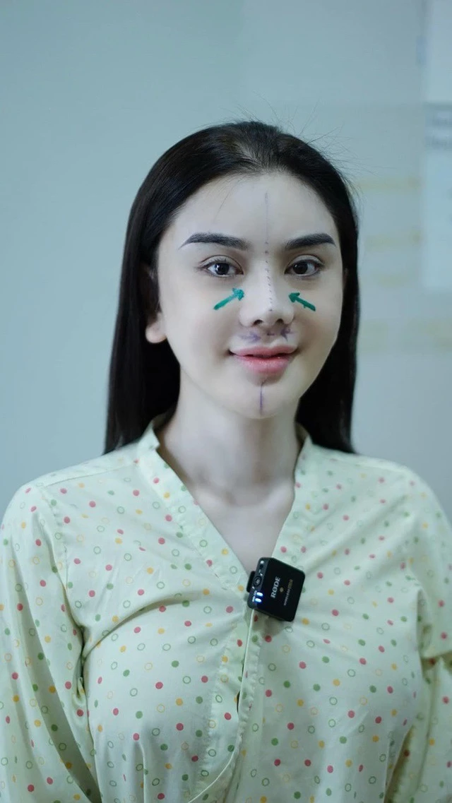 Sao nữ Vbiz bị hải quan giữ lại vì mặt lạ hoắc sau khi phẫu thuật thẩm mỹ, thừa nhận sức khỏe yếu đi rõ rệt - Hình 4