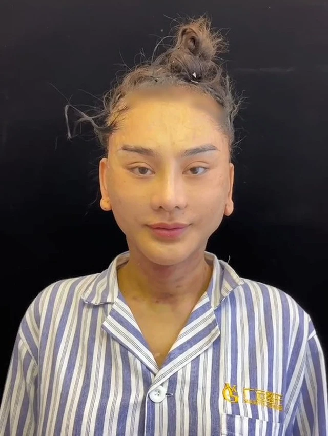 Sao nữ Vbiz bị hải quan giữ lại vì mặt lạ hoắc sau khi phẫu thuật thẩm mỹ, thừa nhận sức khỏe yếu đi rõ rệt - Hình 5