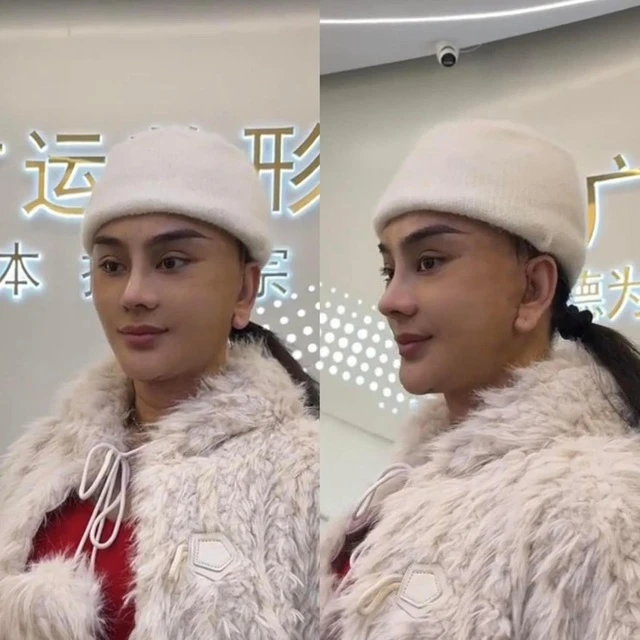 Sao nữ Vbiz bị hải quan giữ lại vì mặt lạ hoắc sau khi phẫu thuật thẩm mỹ, thừa nhận sức khỏe yếu đi rõ rệt - Hình 7