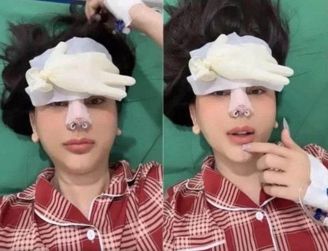 Sao nữ Vbiz bị hải quan giữ lại vì mặt lạ hoắc sau khi phẫu thuật thẩm mỹ, thừa nhận sức khỏe yếu đi rõ rệt - Hình 3