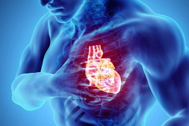 Hiểu đúng về đột tử và đột quỵ để tránh hậu quả nghiêm trọng - Hình 3