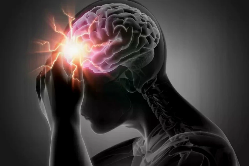 Hiểu đúng về đột tử và đột quỵ để tránh hậu quả nghiêm trọng - Hình 1