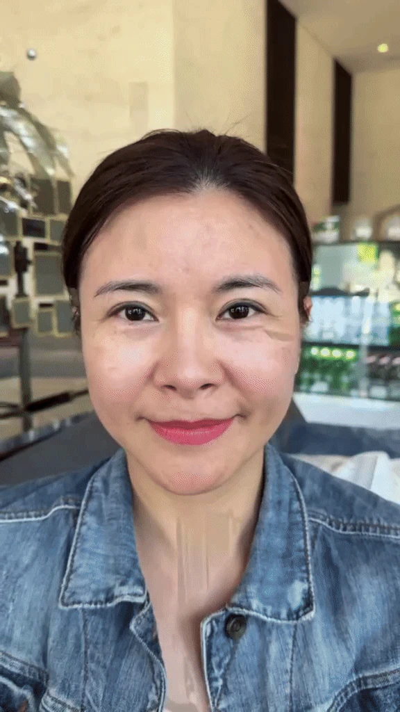 Diễn viên Vbiz đập mặt xây lại ở Hàn: Mặt băng bó chằng chịt, 2 đêm đầu khó chịu không thể thở - Hình 2