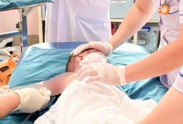 Hà Nội: 3 trẻ trong một gia đình bị bỏng do lật nồi lẩu - Hình 1