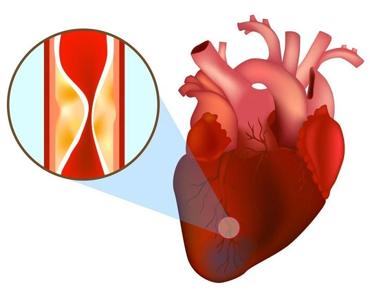 Ngôi sao 18 Lina Bina đột ngột qua đời, nguyên nhân sốc, hé lộ bài đăng cuối - Hình 5