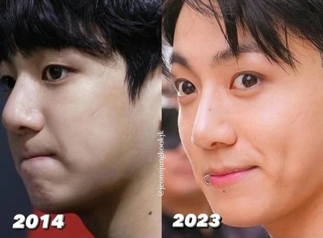 Jungkook (BTS) lộ sụn mũi ở sự kiện tầm cỡ, cư dân mạng nghi dao kéo lỗi? - Hình 4