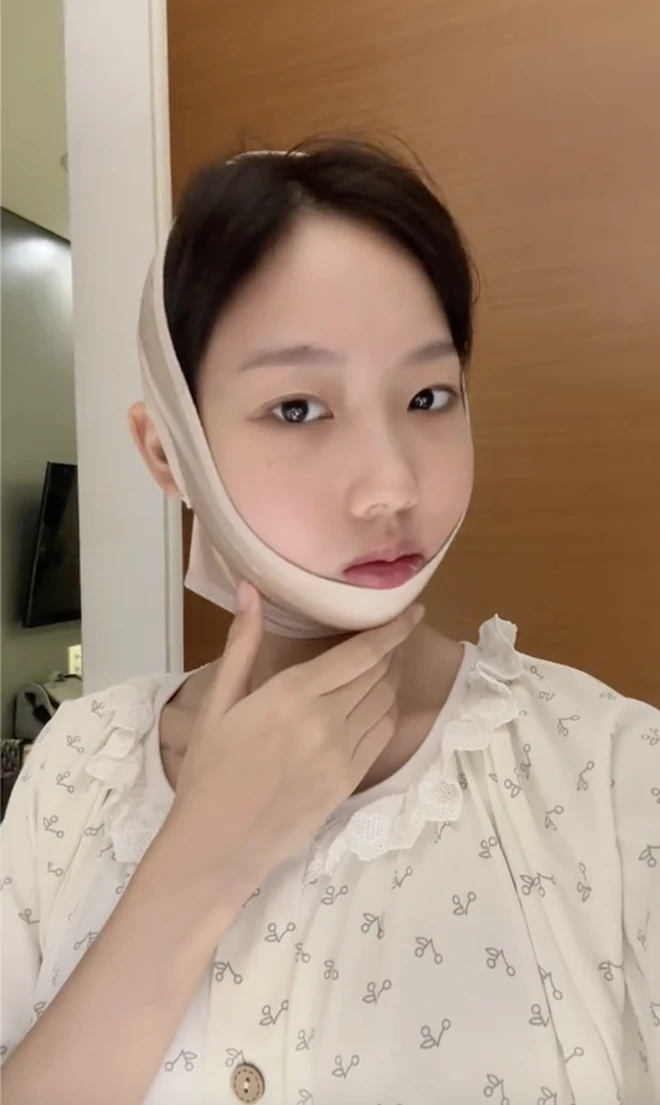 Phản diện Yuna Vũ mặt mũi biến dạng, nghi vấn phẩu thuật thẩm mỹ lỗi, fan sốc? - Hình 3