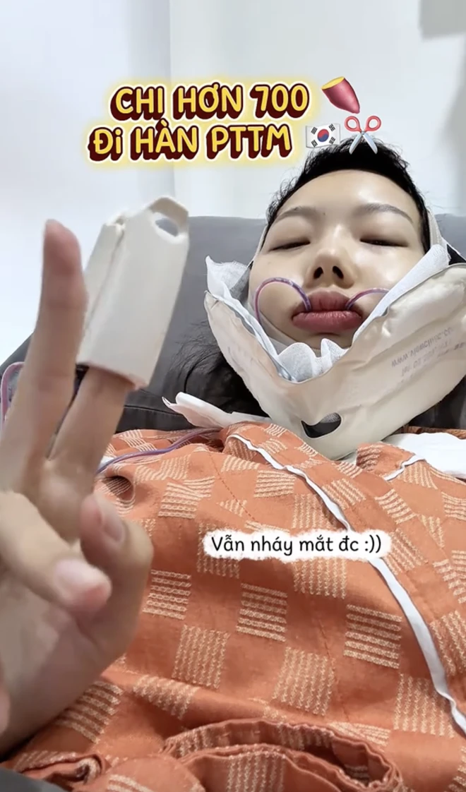 Phản diện Yuna Vũ mặt mũi biến dạng, nghi vấn phẩu thuật thẩm mỹ lỗi, fan sốc? - Hình 2