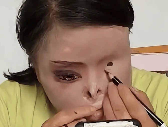 Trung Quốc: Bị chồng cũ tạt axit gây biến dạng, người phụ nữ tự vẽ lại mặt - Hình 1