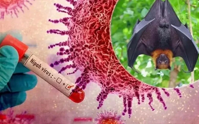 Bác sĩ khuyến cáo 5 vật dụng bảo hộ thiết yếu phải chuẩn bị để phòng virus Nipah - Hình 2