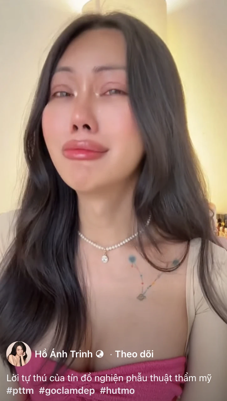 Mỹ nhân chuyển giới An Giang khóc lóc suy sụp sau khi tiêm mỡ toàn mặt - Hình 4