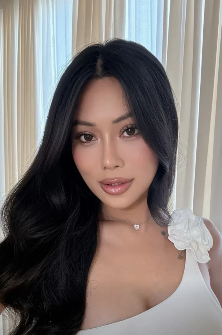 Mỹ nhân chuyển giới An Giang khóc lóc suy sụp sau khi tiêm mỡ toàn mặt - Hình 7