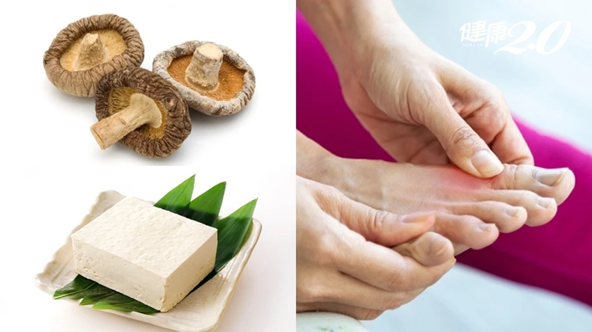 Chế độ ăn cho người bị bệnh gout: Khuyên dùng 4 cao thủ hạ axit uric, đậu phụ là một trong số đó - Hình 2
