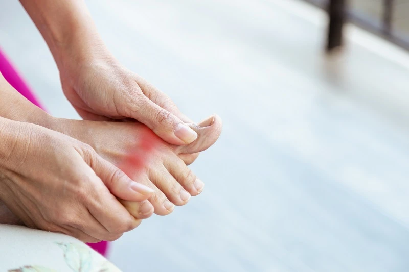 Chế độ ăn cho người bị bệnh gout: Khuyên dùng 4 cao thủ hạ axit uric, đậu phụ là một trong số đó - Hình 1